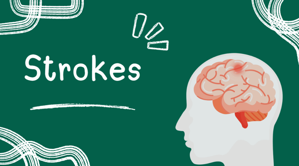 stroke is conditions where cognitive rehabilitation is used